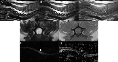 Diffusion-Weighted Imaging Findings of Ischemic Spinal Injury in a Chondrodystrophic Dog With Fibrocartilaginous Embolism